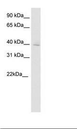 DMBX1 / OTX3 Antibody - Brain Lysate.  This image was taken for the unconjugated form of this product. Other forms have not been tested.