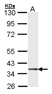 DMC1 Antibody - Sample (30 ug of whole cell lysate). A: Molt-4 . 10% SDS PAGE. DMC1 antibody diluted at 1:1000.