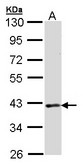 DMC1 Antibody - Sample (30 ug of whole cell lysate). A: Raji. 10% SDS PAGE. DMC1 antibody diluted at 1:1000.