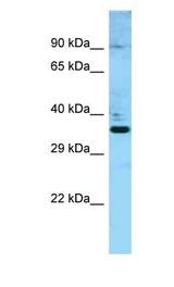 DMC1 Antibody - DMC1 antibody Western Blot of Fetal Heart. Antibody dilution: 1 ug/ml.  This image was taken for the unconjugated form of this product. Other forms have not been tested.