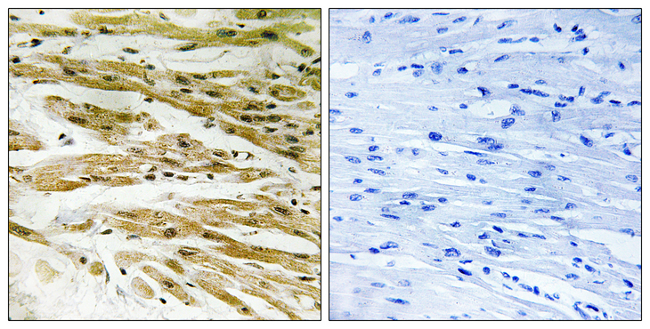 DMC1 Antibody - Immunohistochemistry analysis of paraffin-embedded human heart tissue, using DMC1 Antibody. The picture on the right is blocked with the synthesized peptide.