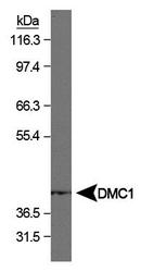 DMC1 Antibody - DMC1 Antibody (1D12/4) - Western blot of DMC1 on human testis.