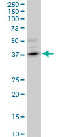 DMC1 Antibody - DMC1 monoclonal antibody (M10), clone 4A10. Western blot of DMC1 expression in PC-12.