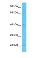 DMC1 Antibody - Western blot of DMC1 Antibody with human Jurkat Whole Cell lysate.  This image was taken for the unconjugated form of this product. Other forms have not been tested.