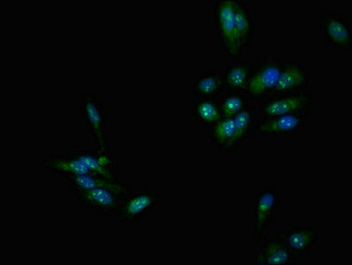 DMC1 Antibody - Immunofluorescent analysis of Hela cells at a dilution of 1:100 and Alexa Fluor 488-congugated AffiniPure Goat Anti-Rabbit IgG(H+L)