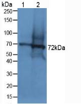 DMD / Dystrophin Antibody - Western Blot; Sample: Lane1: Human Lung Tissue; Lane2: Mouse Testis Tissue.