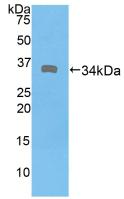 DMD / Dystrophin Antibody - Western Blot; Sample: Recombinant DMD, Human.