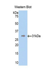 DMD / Dystrophin Antibody - Western blot of recombinant DMD / Dystrophin.  This image was taken for the unconjugated form of this product. Other forms have not been tested.