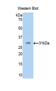 DMD / Dystrophin Antibody - Western blot of recombinant DMD / Dystrophin.  This image was taken for the unconjugated form of this product. Other forms have not been tested.