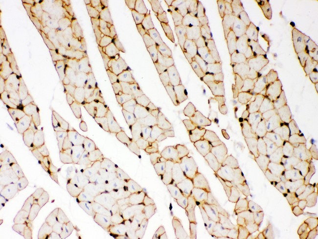 DMD / Dystrophin Antibody - Dystrophin antibody IHC-paraffin: Rat Cardiac Muscle Tissue.