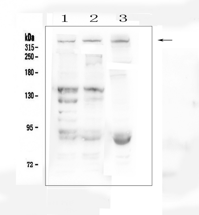DMD / Dystrophin Antibody - Western blot analysis of Dystrophin using anti-Dystrophin antibody. Electrophoresis was performed on a 5-20% SDS-PAGE gel at 70V (Stacking gel) / 90V (Resolving gel) for 2-3 hours. The sample well of each lane was loaded with 50ug of sample under reducing conditions. Lane 1: human HEK293 whole cell lysates, Lane 2: human K562 whole cell lysates, Lane 3: mouse HEPA1-6 whole cell lysates, After Electrophoresis, proteins were transferred to a Nitrocellulose membrane at 150mA for 50-90 minutes. Blocked the membrane with 5% Non-fat Milk/ TBS for 1.5 hour at RT. The membrane was incubated with rabbit anti-Dystrophin antigen affinity purified polyclonal antibody at 0.5 µg/mL overnight at 4°C, then washed with TBS-0.1% Tween 3 times with 5 minutes each and probed with a goat anti-rabbit IgG-HRP secondary antibody at a dilution of 1:10000 for 1.5 hour at RT. The signal is developed using an Enhanced Chemiluminescent detection (ECL) kit with Tanon 5200 system. A specific band was detected for Dystrophin at approximately 427KD. The expected band size for Dystrophin is at 427KD.