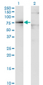 DMD / Dystrophin Antibody - Western Blot analysis of DMD expression in transfected 293T cell line by DMD monoclonal antibody (M07), clone 3A11.Lane 1: DMD transfected lysate(72.2 KDa).Lane 2: Non-transfected lysate.