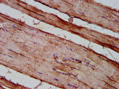 DMD / Dystrophin Antibody - Immunohistochemistry Dilution at 1:200 and staining in paraffin-embedded human skeletal muscle tissue performed on a Leica BondTM system. After dewaxing and hydration, antigen retrieval was mediated by high pressure in a citrate buffer (pH 6.0). Section was blocked with 10% normal Goat serum 30min at RT. Then primary antibody (1% BSA) was incubated at 4°C overnight. The primary is detected by a biotinylated Secondary antibody and visualized using an HRP conjugated SP system.