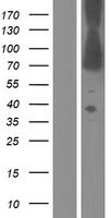 DMD / Dystrophin Protein - Western validation with an anti-DDK antibody * L: Control HEK293 lysate R: Over-expression lysate