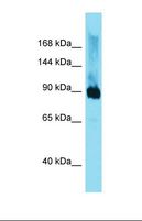 DMGDH Antibody - Western blot of Mouse Liver. Dmgdh antibody dilution 1.0 ug/ml.  This image was taken for the unconjugated form of this product. Other forms have not been tested.