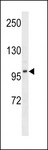 DMGDH Antibody - DMGDH Antibody western blot of MDA-MB453 cell line lysates (35 ug/lane). The DMGDH antibody detected the DMGDH protein (arrow).
