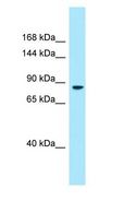 DMGDH Antibody - DMGDH antibody Western Blot of Fetal Liver.  This image was taken for the unconjugated form of this product. Other forms have not been tested.