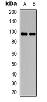 DMGDH Antibody - Western blot analysis of DMGDH expression in HepG2 (A); A549 (B) whole cell lysates.