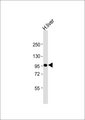 DMGDH Antibody - Anti-DMGDH Antibody at 1:1000 dilution + human liver lysate Lysates/proteins at 20 ug per lane. Secondary Goat Anti-Rabbit IgG, (H+L), Peroxidase conjugated at 1:10000 dilution. Predicted band size: 97 kDa. Blocking/Dilution buffer: 5% NFDM/TBST.