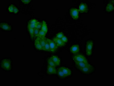 DMGDH Antibody - Immunofluorescence staining of HepG2 cells at a dilution of 1:100, counter-stained with DAPI. The cells were fixed in 4% formaldehyde, permeabilized using 0.2% Triton X-100 and blocked in 10% normal Goat Serum. The cells were then incubated with the antibody overnight at 4 °C.The secondary antibody was Alexa Fluor 488-congugated AffiniPure Goat Anti-Rabbit IgG (H+L) .
