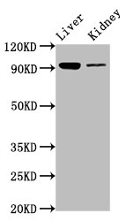 DMGDH Antibody - Positive Western Blot detected in Mouse liver tissue, Mouse kidney tissue. All lanes: DMGDH antibody at 6.7 µg/ml Secondary Goat polyclonal to rabbit IgG at 1/50000 dilution. Predicted band size: 97, 46 KDa. Observed band size: 97 KDa
