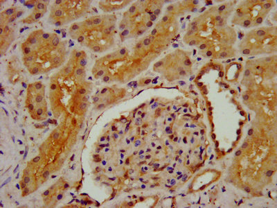 DMGDH Antibody - IHC image of DMGDH Antibody diluted at 1:300 and staining in paraffin-embedded human kidney tissue performed on a Leica BondTM system. After dewaxing and hydration, antigen retrieval was mediated by high pressure in a citrate buffer (pH 6.0). Section was blocked with 10% normal goat serum 30min at RT. Then primary antibody (1% BSA) was incubated at 4°C overnight. The primary is detected by a biotinylated secondary antibody and visualized using an HRP conjugated SP system.