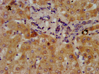 DMGDH Antibody - IHC image of DMGDH Antibody diluted at 1:300 and staining in paraffin-embedded human liver tissue performed on a Leica BondTM system. After dewaxing and hydration, antigen retrieval was mediated by high pressure in a citrate buffer (pH 6.0). Section was blocked with 10% normal goat serum 30min at RT. Then primary antibody (1% BSA) was incubated at 4°C overnight. The primary is detected by a biotinylated secondary antibody and visualized using an HRP conjugated SP system.