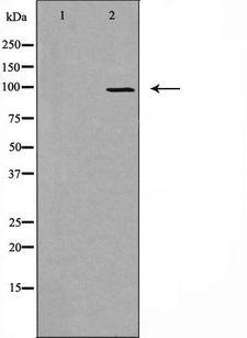 DMGDH Antibody - Western blot analysis of extracts of HT29 cells using DMGDH antibody. The lane on the left is treated with the antigen-specific peptide.