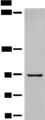 DMGDH Antibody - Western blot analysis of Human fetal liver tissue lysate  using DMGDH Polyclonal Antibody at dilution of 1:800