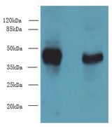 DMKN Antibody - Western blot. All lanes: DMKN antibody at 6 ug/ml. Lane 1: Mouse kidney tissue. Lane 2: Mouse liver tissue. Secondary Goat polyclonal to Rabbit IgG at 1:10000 dilution. Predicted band size: 47 kDa. Observed band size: 47 kDa.
