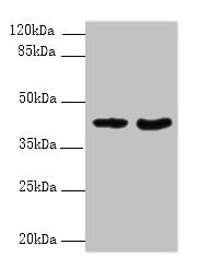 DMKN Antibody - Western blot All lanes: DMKN antibody at 6µg/ml Lane 1: Mouse kidney tissue Lane 2: Mouse liver tissue Secondary Goat polyclonal to rabbit IgG at 1/10000 dilution Predicted band size: 48, 16, 37, 46, 39, 42, 36, 21, 19, 17, 15, 10, 47 kDa Observed band size: 42 kDa