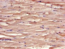 DMN / Desmuslin / Synemin Antibody - Immunohistochemistry image of paraffin-embedded human skeletal muscle tissue at a dilution of 1:100