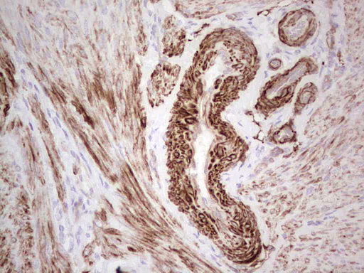 DMN / Desmuslin / Synemin Antibody - Immunohistochemical staining of paraffin-embedded Human endometrium tissue within the normal limits using anti-SYNM mouse monoclonal antibody. (Heat-induced epitope retrieval by 1 mM EDTA in 10mM Tris, pH8.5, 120C for 3min,