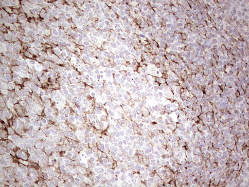 DMN / Desmuslin / Synemin Antibody - Immunohistochemical staining of paraffin-embedded Human tonsil within the normal limits using anti-SYNM mouse monoclonal antibody. (Heat-induced epitope retrieval by 1 mM EDTA in 10mM Tris, pH8.5, 120C for 3min,