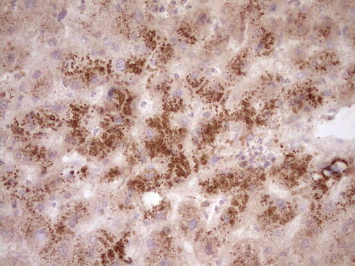 DMN / Desmuslin / Synemin Antibody - Immunohistochemical staining of paraffin-embedded Human liver tissue within the normal limits using anti-SYNM mouse monoclonal antibody. (Heat-induced epitope retrieval by 1 mM EDTA in 10mM Tris, pH8.5, 120C for 3min,