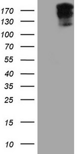 DMN / Desmuslin / Synemin Antibody - HEK293T cells were transfected with the pCMV6-ENTRY control. (Left lane) or pCMV6-ENTRY SYNM. (Right lane) cDNA for 48 hrs and lysed. Equivalent amounts of cell lysates. (5 ug per lane) were separated by SDS-PAGE and immunoblotted with anti-SYNM.