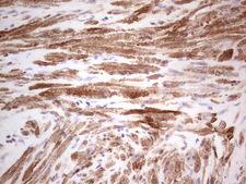 DMN / Desmuslin / Synemin Antibody - Immunohistochemical staining of paraffin-embedded Human prostate tissue within the normal limits using anti-SYNM mouse monoclonal antibody.  heat-induced epitope retrieval by 1 mM EDTA in 10mM Tris, pH8.5, 120C for 3min)