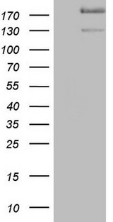 DMN / Desmuslin / Synemin Antibody - HEK293T cells were transfected with the pCMV6-ENTRY control. (Left lane) or pCMV6-ENTRY SYNM. (Right lane) cDNA for 48 hrs and lysed. Equivalent amounts of cell lysates. (5 ug per lane) were separated by SDS-PAGE and immunoblotted with anti-SYNM.