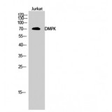 DMPK / DM Antibody - Western blot of DMPK antibody