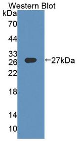 DMPK / DM Antibody - Western blot of DMPK / DM antibody.