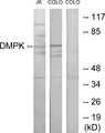 DMPK / DM Antibody - Western blot analysis of lysates from Jurkat and COLO205 cells, using DMPK Antibody. The lane on the right is blocked with the synthesized peptide.