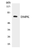 DMPK / DM Antibody - Western blot analysis of the lysates from HT-29 cells using DMPK antibody.