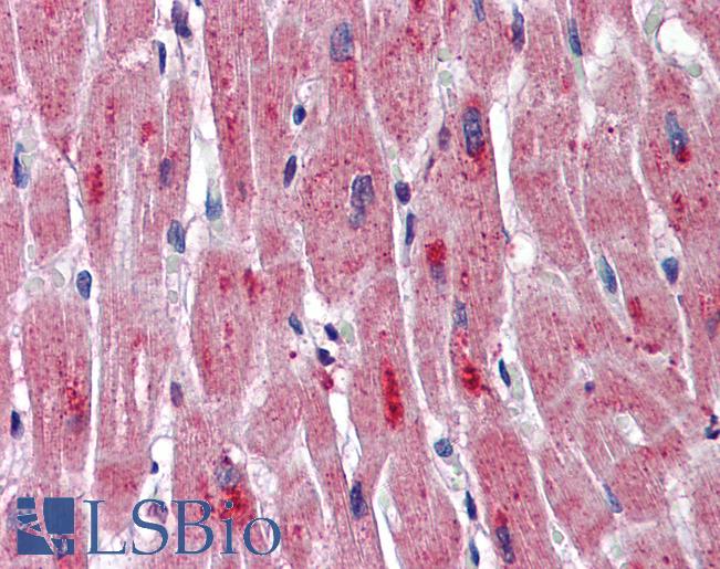 DMPK / DM Antibody - Anti-DMPK antibody IHC of human heart. Immunohistochemistry of formalin-fixed, paraffin-embedded tissue after heat-induced antigen retrieval. Antibody concentration 5 ug/ml.  This image was taken for the unconjugated form of this product. Other forms have not been tested.