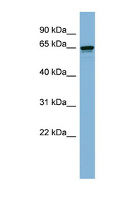 DMPK / DM Antibody - DMPK antibody Western blot of ACHN lysate. This image was taken for the unconjugated form of this product. Other forms have not been tested.
