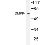 DMPK / DM Antibody - Western blot of DMPK (R30) pAb in extracts from Jurkat cell.