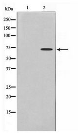 DMPK / DM Antibody - Western blot of Jurkat cell lysate using DMPK Antibody