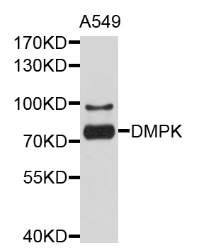 DMPK / DM Antibody - Western blot analysis of extracts of A-549 cells, using DMPK antibody at 1:1000 dilution. The secondary antibody used was an HRP Goat Anti-Rabbit IgG (H+L) at 1:10000 dilution. Lysates were loaded 25ug per lane and 3% nonfat dry milk in TBST was used for blocking. An ECL Kit was used for detection and the exposure time was 5s.