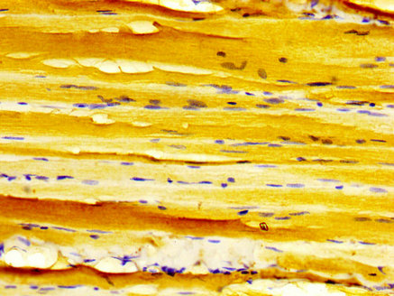 DMPK / DM Antibody - Immunohistochemistry image at a dilution of 1:500 and staining in paraffin-embedded human skeletal muscle tissue performed on a Leica BondTM system. After dewaxing and hydration, antigen retrieval was mediated by high pressure in a citrate buffer (pH 6.0) . Section was blocked with 10% normal goat serum 30min at RT. Then primary antibody (1% BSA) was incubated at 4 °C overnight. The primary is detected by a biotinylated secondary antibody and visualized using an HRP conjugated SP system.