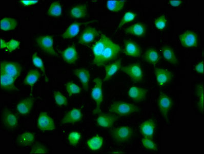 DMPK / DM Antibody - Immunofluorescence staining of A549 cells with DMPK Antibody at 1:166, counter-stained with DAPI. The cells were fixed in 4% formaldehyde, permeabilized using 0.2% Triton X-100 and blocked in 10% normal Goat Serum. The cells were then incubated with the antibody overnight at 4°C. The secondary antibody was Alexa Fluor 488-congugated AffiniPure Goat Anti-Rabbit IgG(H+L).