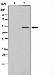 DMPK / DM Antibody - Western blot analysis on Jurkat cell lysates using DMPK antibody. The lane on the left is treated with the antigen-specific peptide.
